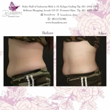 gallery img: Slimming