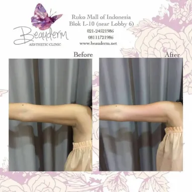 gallery img: Slimming