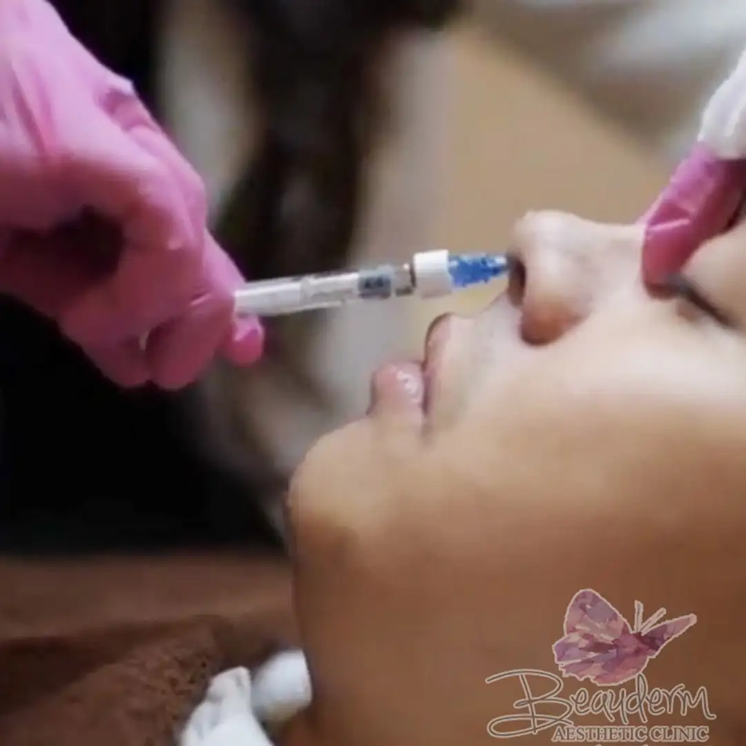 Nose Filler