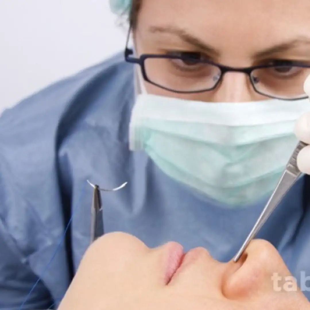 Rekonstruksi Hidung Jangan Sekedar Mancung, Tapi Harus Proporsional